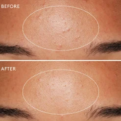 Daily Microfoliant Exfoliant Poudre