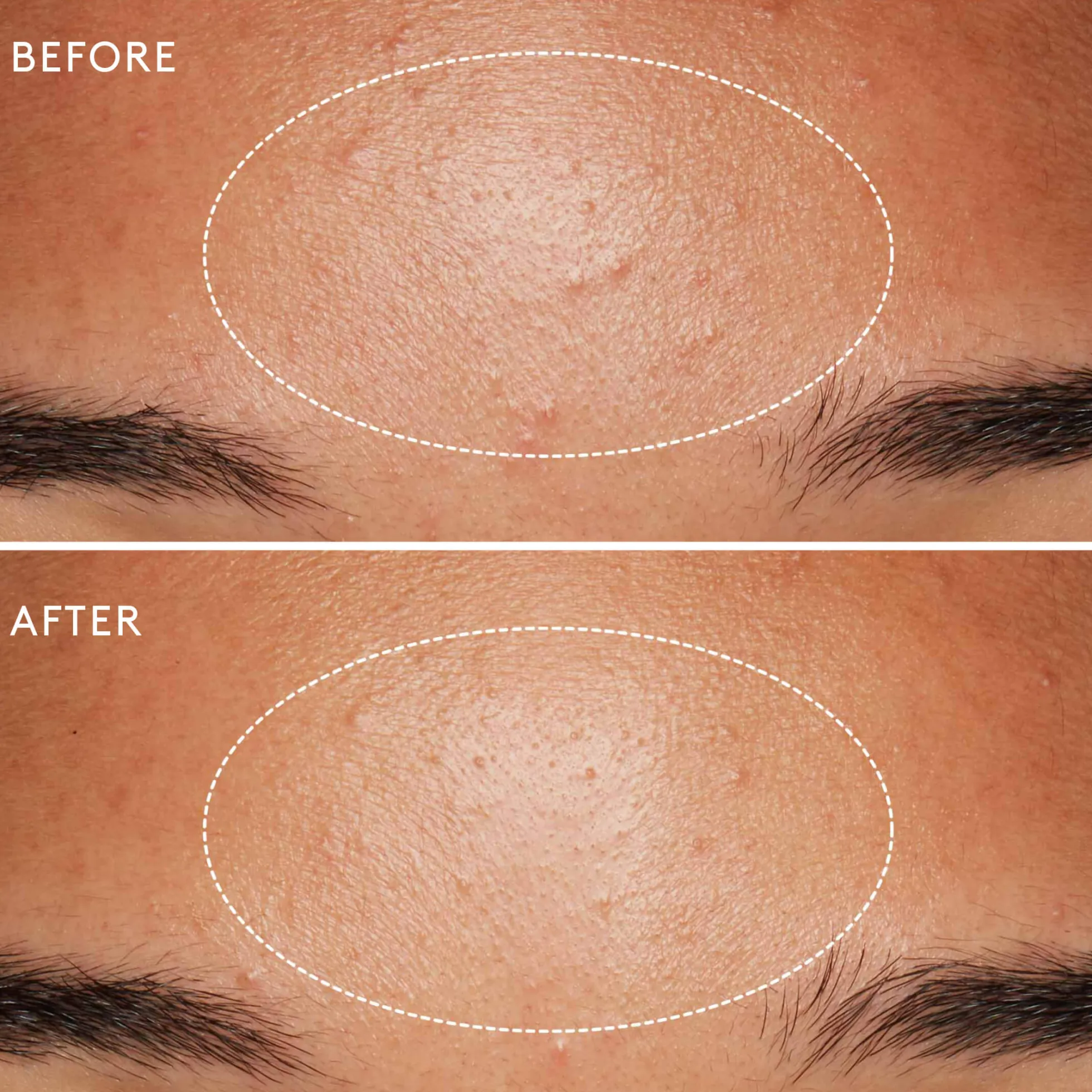 Daily Microfoliant Exfoliant Poudre