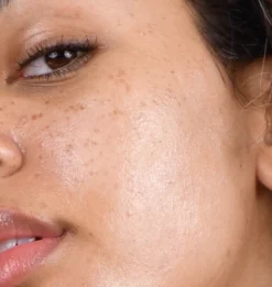 Good Genes All-In-One Lactic Acid Treatment Sérum