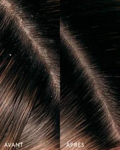 Huile Remède Cuir Chevelu Aceite de Moska