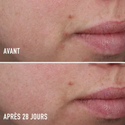 Soin Ciblé Anti-Imperfections