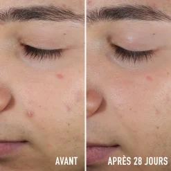 Sérum Anti-Imperfections