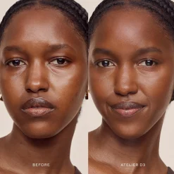 Vital Skincare Concealer Correcteur